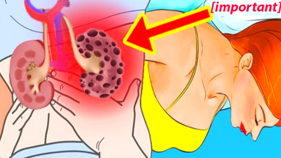 How kidneys hurt: 12 symptoms that cannot be confused
