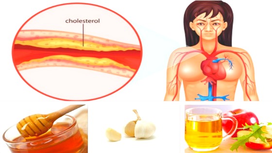 How to lower cholesterol levels naturally at home