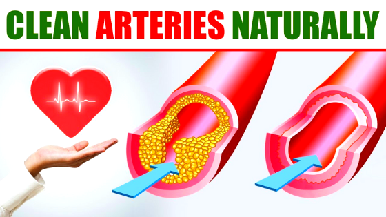 Top 15 Foods That Unclog Arteries Naturally( must know)