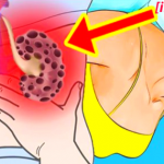 How kidneys hurt: 12 symptoms that cannot be confused